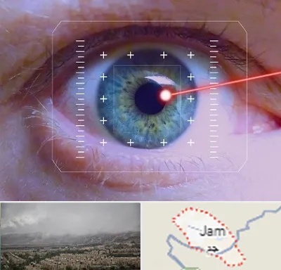 فمتولیزیک در جم