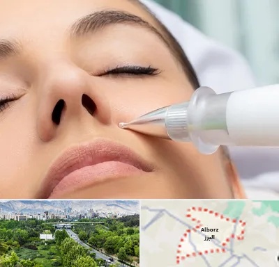 پلاسما جت بینی در البرز