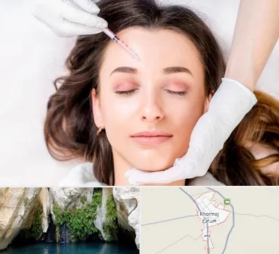 مزوتراپی ابرو در خورموج