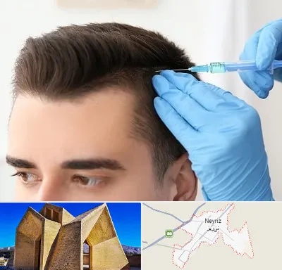 مزوتراپی مو در نی ریز