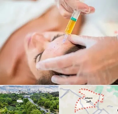 پی آر پی در البرز