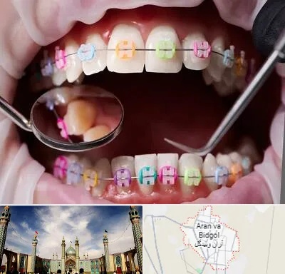 متخصص ارتودنسی در آران و بیدگل