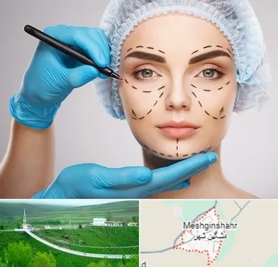 جراح فک و صورت در مشگین شهر
