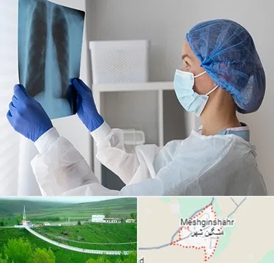 جراح سرطان مغز و استخوان در مشگین شهر