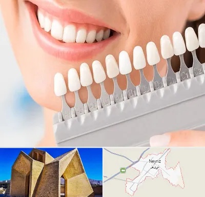 متخصص لمینت دندان در نی ریز