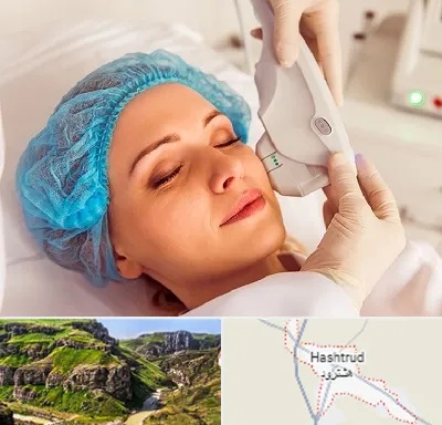 اکسنت در هشترود