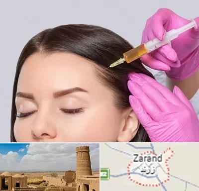 تزریق هیر فیلر در زرند