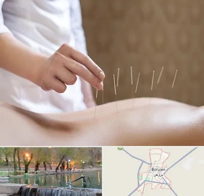 درای نیدلینگ در بروجن