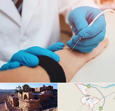مرکز نوار عصب و عضله در قائن