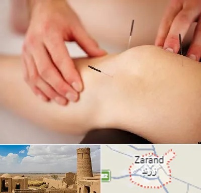 دکتر طب سوزنی برای لاغری در زرند