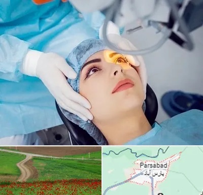 دکتر عمل لیزیک چشم در پارس آباد