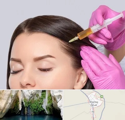 تزریق هیر فیلر در خورموج