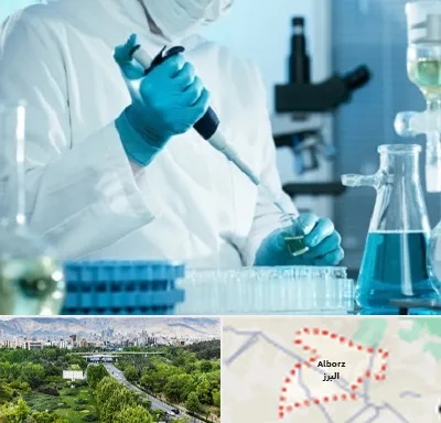 آزمایشگاه HIV در البرز