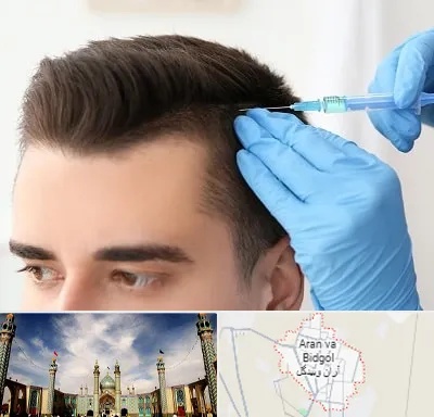 مزوتراپی مو در آران و بیدگل