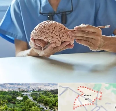 دکتر نورولوژی در البرز