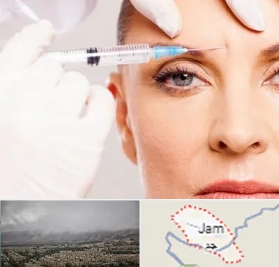 مزوژل در جم