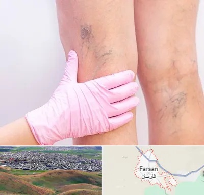 دکتر فوق تخصص واریس در فارسان