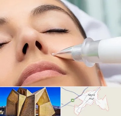 پلاسما جت بینی در نی ریز