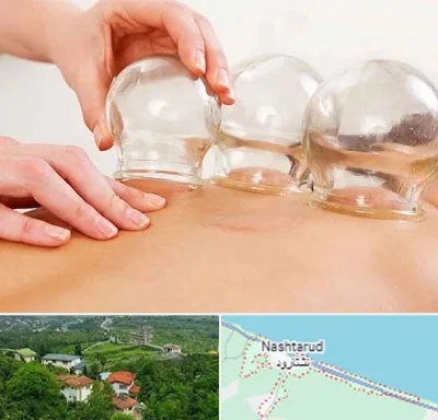 بادکش درمانی در نشتارود