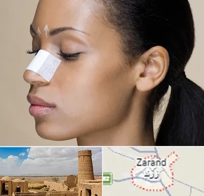 دکتر جراح بینی خانم در زرند