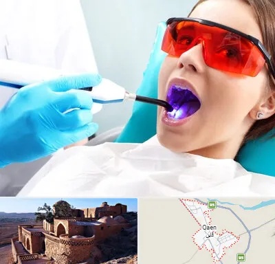 جراحی لثه با لیزر در قائن