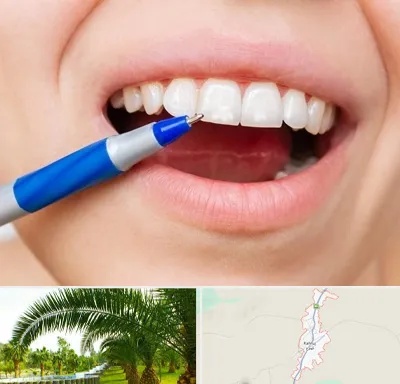 دندانسازی ارزان در کهنوج