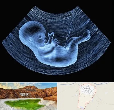 دکتر متخصص غربال گری در گرمسار
