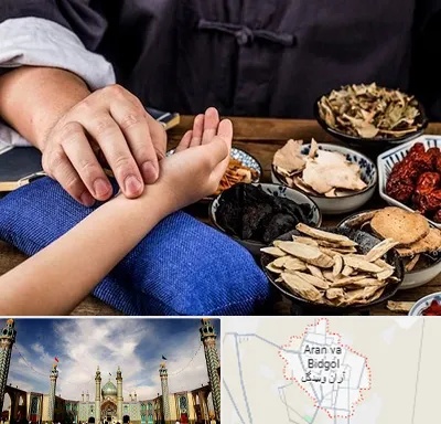 دکتر گیاهی در آران و بیدگل