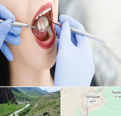 جراح دندان عقل در اشنویه