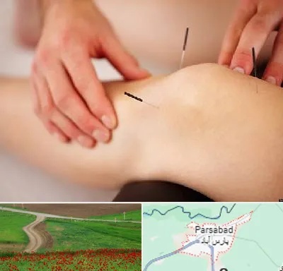 دکتر طب سوزنی برای لاغری در پارس آباد