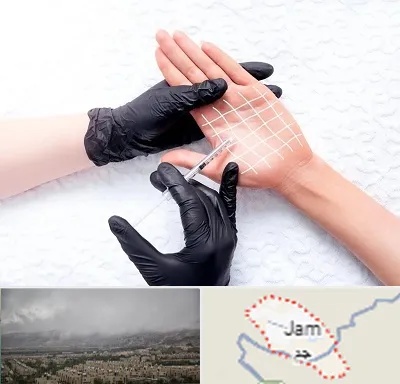 تزریق بوتاکس کف دست در جم
