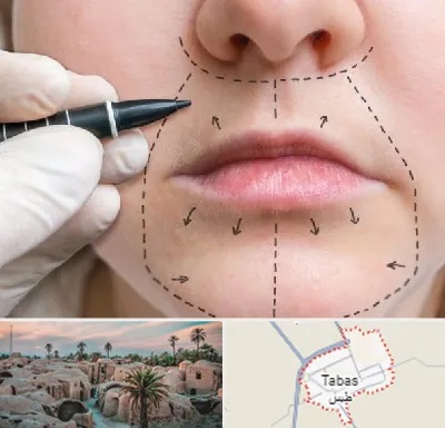 عمل سانترال لب در طبس