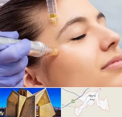 میکرونیدلینگ در نی ریز