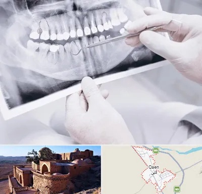 رادیولوژی دهان و دندان در قائن