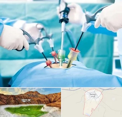 جراح فیبروم در گرمسار