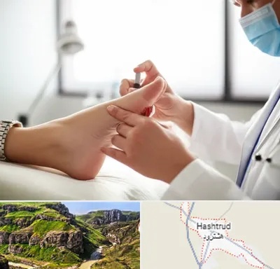 متخصص زخم دیابت در هشترود