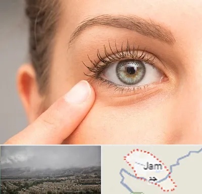 جراح پف چشم در جم