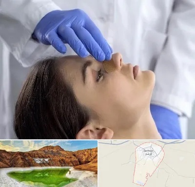 عمل بینی عروسکی در گرمسار