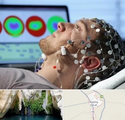 مرکز نوار مغز در خورموج