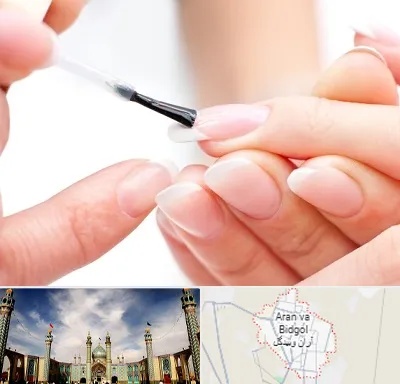 ترمیم کار ناخن در آران و بیدگل