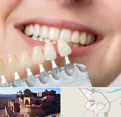 مرکز کامپوزیت دندان در قائن