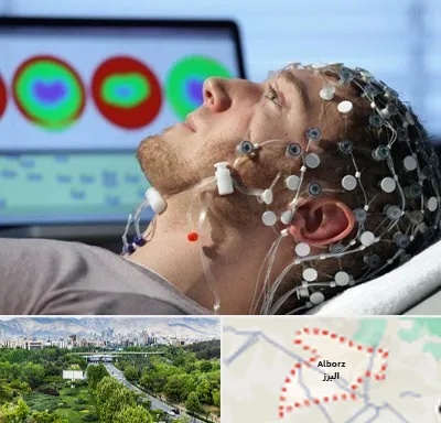 مرکز نوار مغز در البرز
