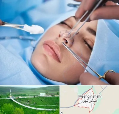 عمل ترمیمی بینی در مشگین شهر