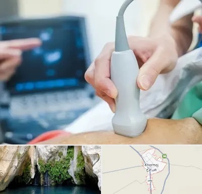 اکو قلب شبانه روزی در خورموج