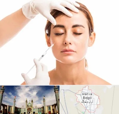 تزریق ژل گونه در آران و بیدگل