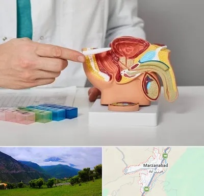 دکتر اورولوژی در مرزن آباد