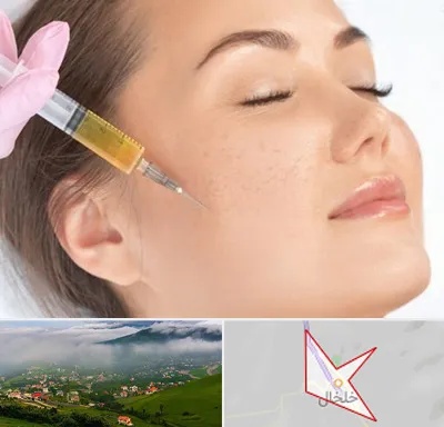 آموزش تزریق ژل و بوتاکس در خلخال