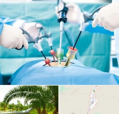 جراح فیبروم در کهنوج
