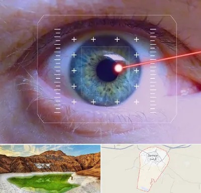 فمتولیزیک در گرمسار