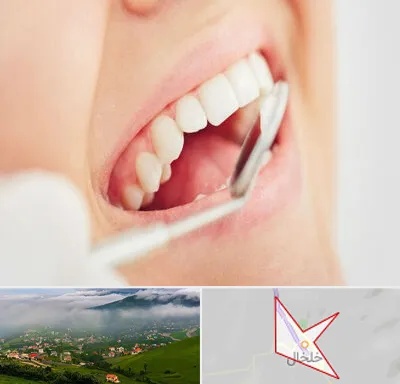 اصلاح طرح لبخند در خلخال